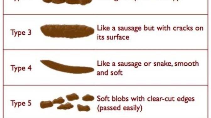 What type is your poop (Image given with 7 types) ?