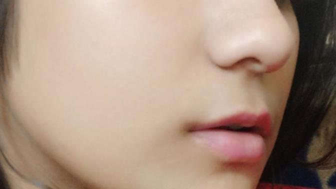 Skin Care solution?