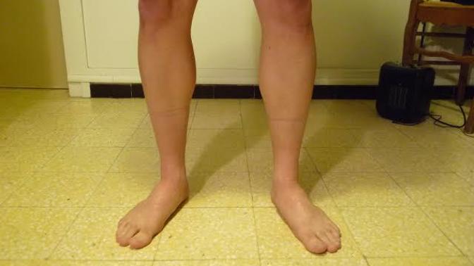 Do you think men remove body hair, what women think?