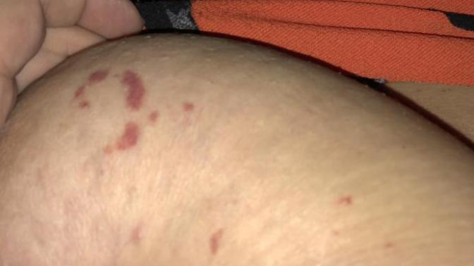 Weird rash help?