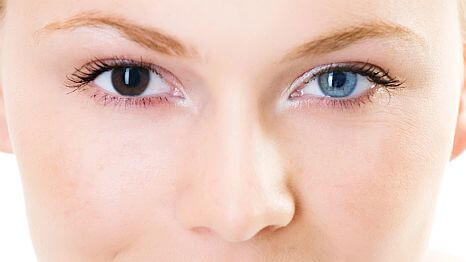 Do you have heterochromia?