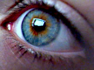 Do you have heterochromia?
