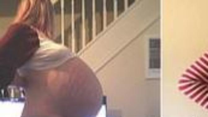 What do you think of this photo of a young female who had this medical problem?
