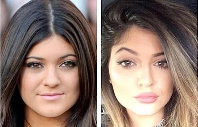 What are your thoughts on plastic surgery?