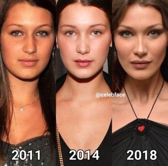 What are your thoughts on plastic surgery?
