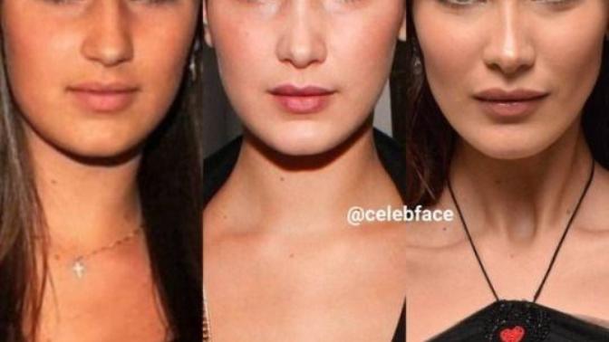 What are your thoughts on plastic surgery?