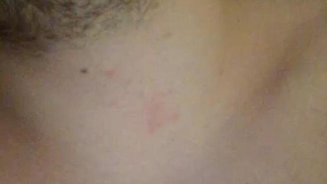 I found a mark on my boyfriends neck, is it a hickey?