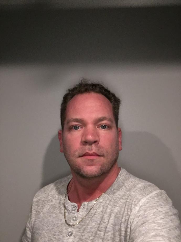 Im 41 and the crown of my head is going bald. Shave or not? Or?