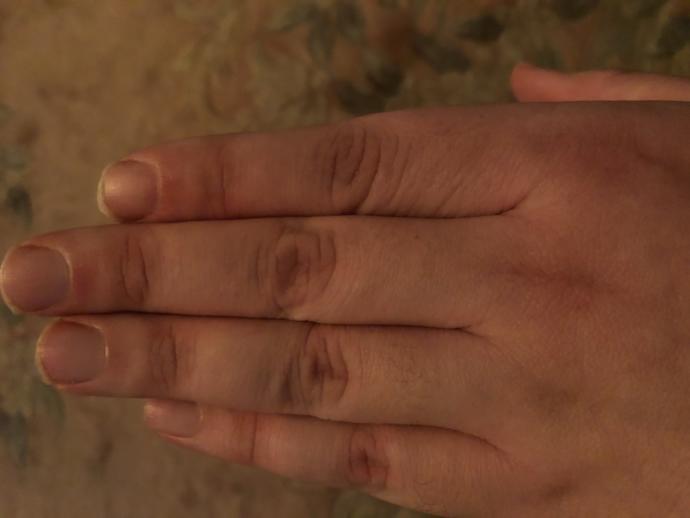 Is this digit ratio rare I was told yes?