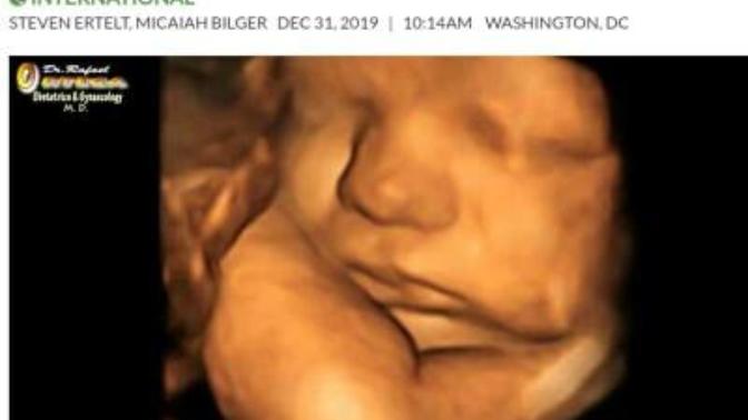 Abortion was the leading cause of death worldwide in 2019. Opinions?