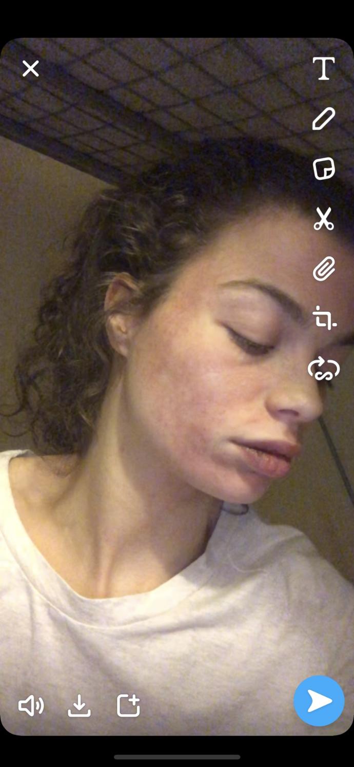 What are these blotchy red marks on my face?