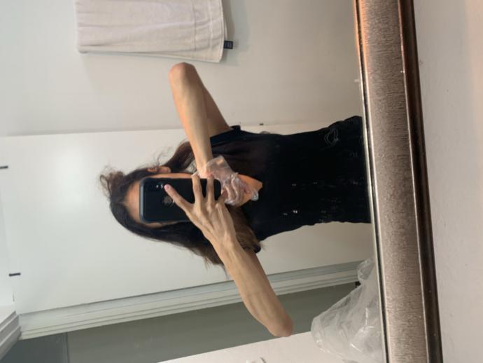 Why I can’t gain weight I’m too skinny help?