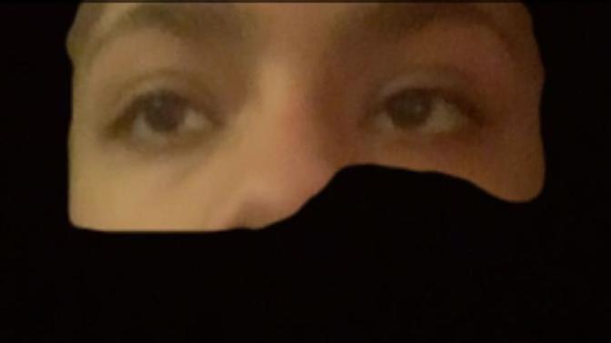 Are my eyes lazy/would you date someone with these eyes?