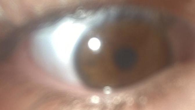 What is my eye color?