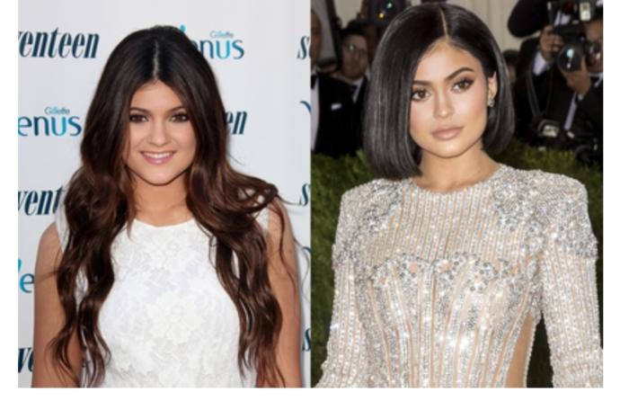 Would you get plastic surgery?