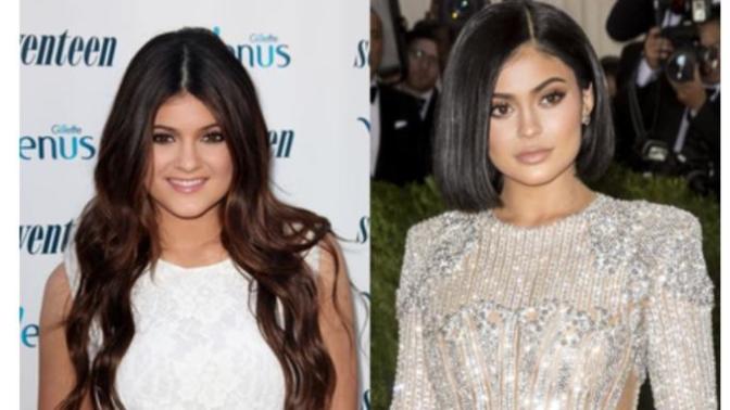Would you get plastic surgery?
