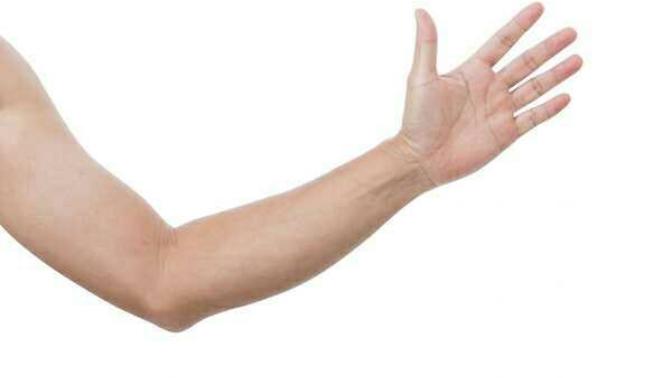 Would you rather lose an arm or a leg?