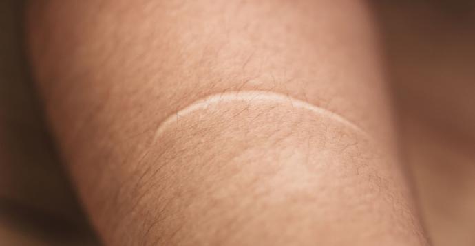 Are scars good or bad to you?