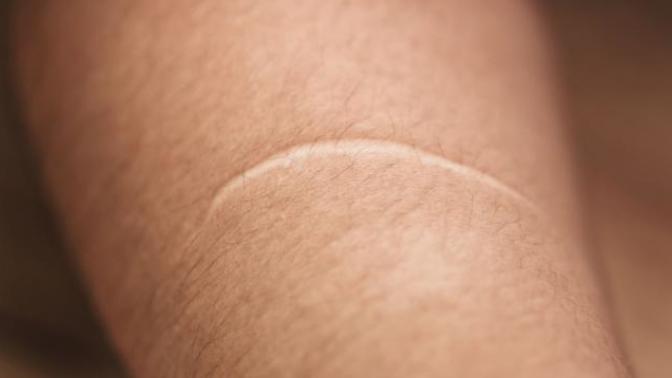 Are scars good or bad to you?