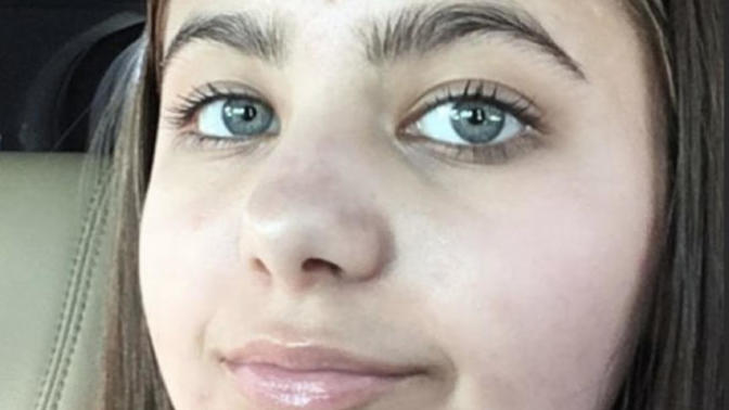 Do you care if a girl has perfect skin or acne?