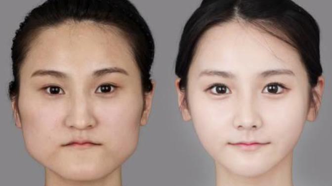 What are your thoughts on plastic surgery?