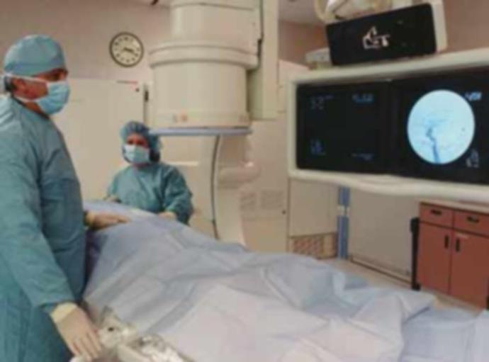 Have you ever had an angiogram before?