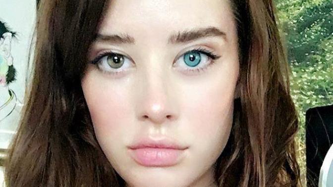Would you date someone with heterochromia iridum/iridis?