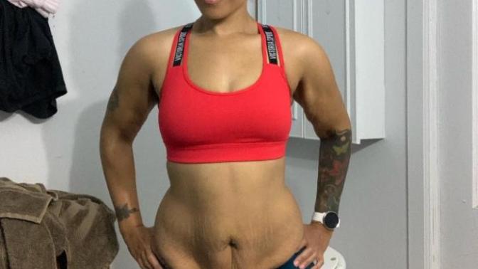 Would you date a girl who's lost a lot of weight and has loose skin?