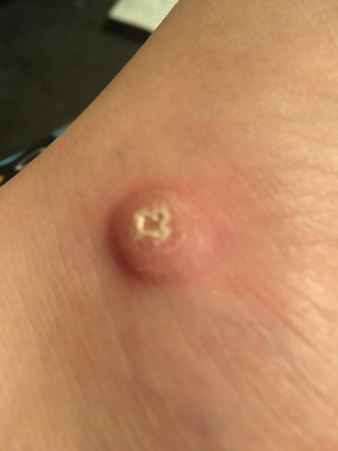 What does this lump look like? Should I go to the Emergency Room even though I don’t have insurance?
