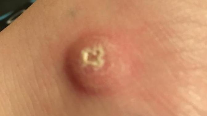 What does this lump look like? Should I go to the Emergency Room even though I don’t have insurance?