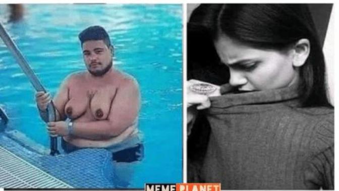 Do you think men who have breasts like women should wear a shirt?