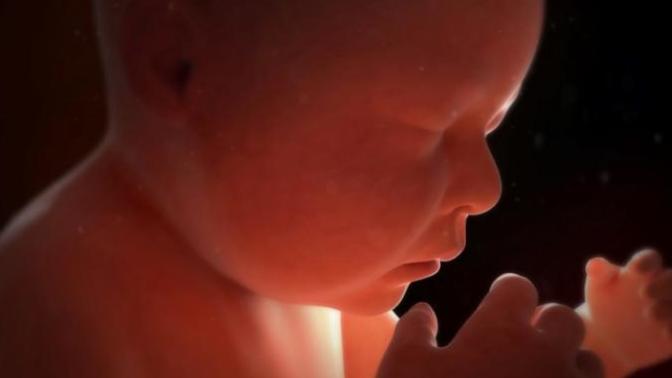 Outside of rape, do you think most women have abortion not because of the child but rather they don't desire to have the child's father in their life?