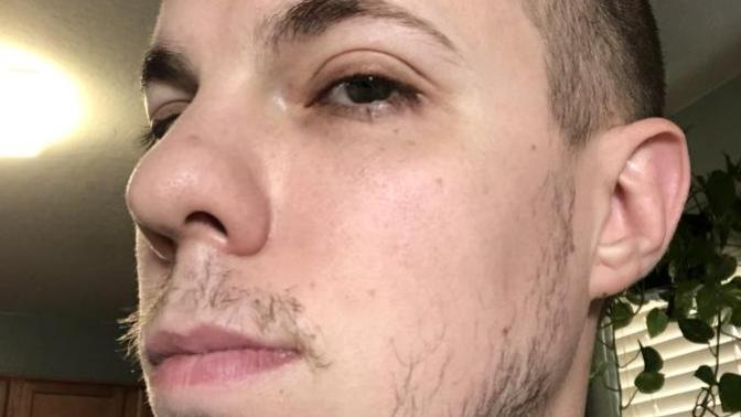 Is my facial hair worth trying to grow out or is it really terrible?