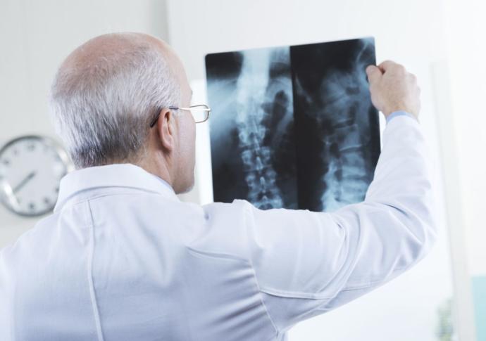 Have you ever broken a bone?