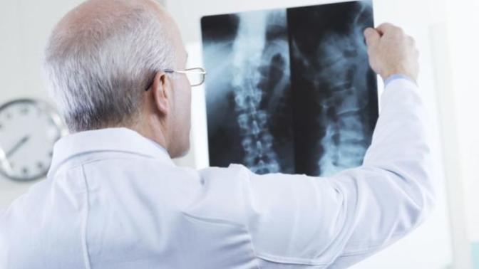 Have you ever broken a bone?