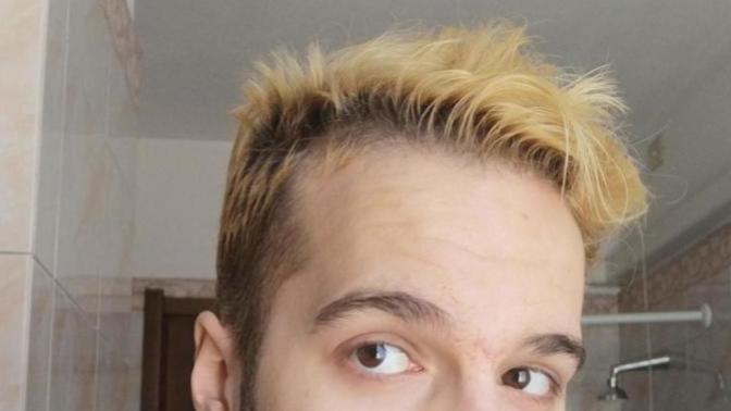 Does it matter if a guy's hairline is receding at the front?