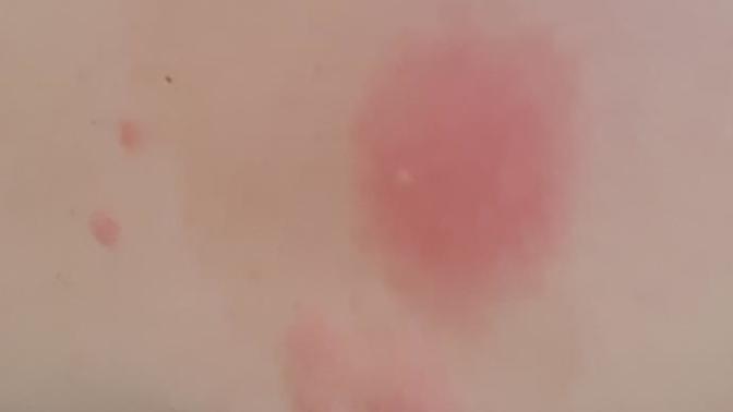 What are these scars on my body🤔?