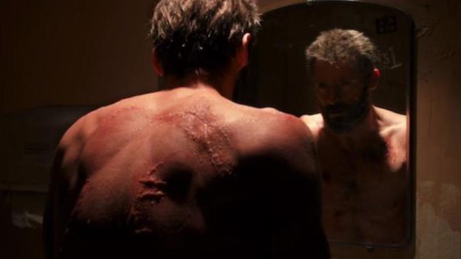 Do you scar easily from physical injury?