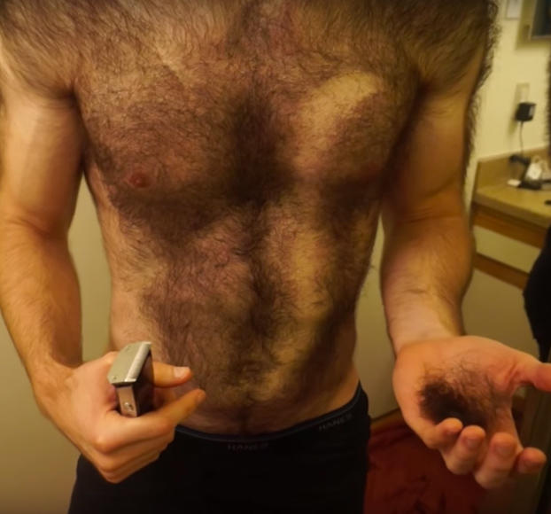 Can being too hairy be a reason to give up on women?