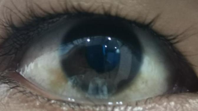 Eye stories~ free to share, why not?