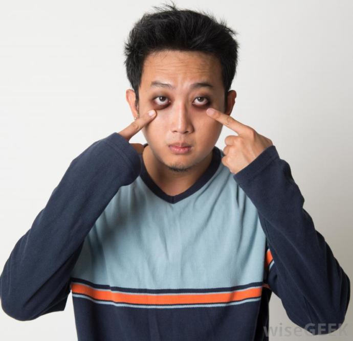 Is there some simple make up that both women and men can use to cover up dark circles?