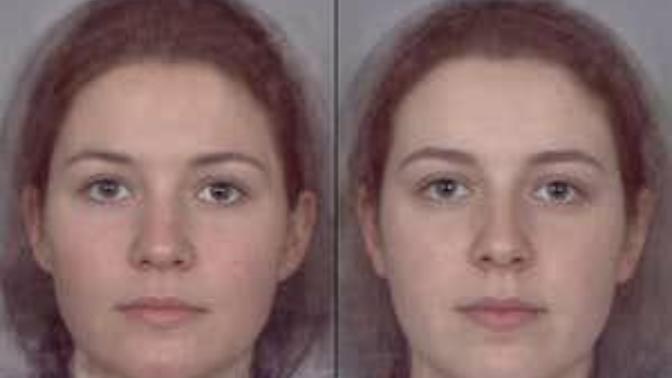Have you ever heard before that higher or lower testosterone and estrogen levels can effect what your face looks like?