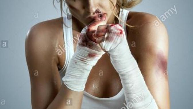 If you're a guy and a girl starts getting physical and starts hitting you!!! Should you hit back or what's the proper way of handling that situation?