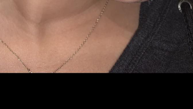 Ignore the acne, Do you find this facial hair too much for a girl?