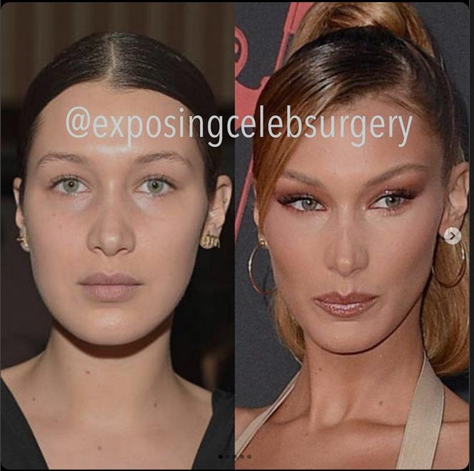 Do you find Instagram beauty standard to be beautiful?