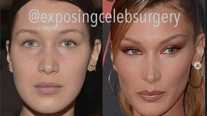 Do you find 'Instagram beauty standard' to be beautiful?