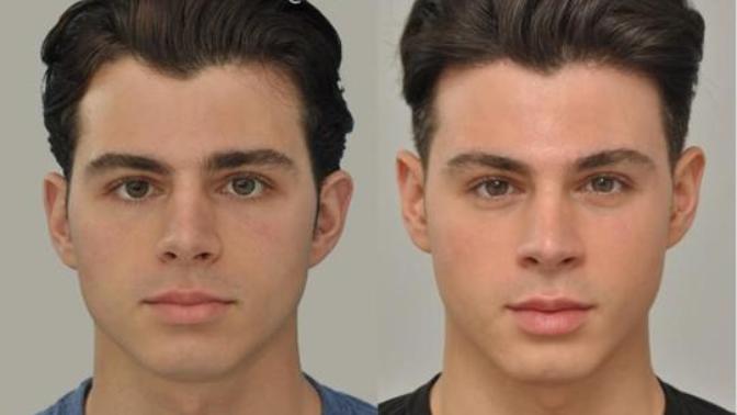 Is plastic surgery worth it?