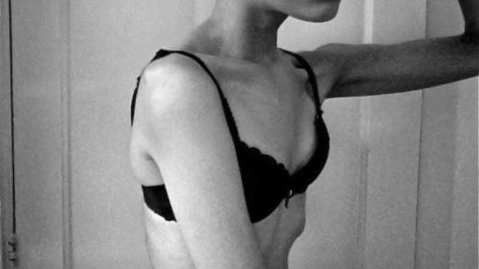 Would you date a girl who’s underweight?