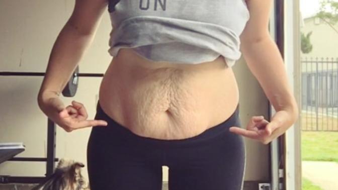 Men would you date a girl/woman if her body looked not so bad with clothes but underneath she actually has excess skin all over from losing weight?
