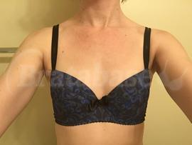 An example of a 26DD off bratabase. It is small because DD isnt enough to cancel out the tiny band size (26in)